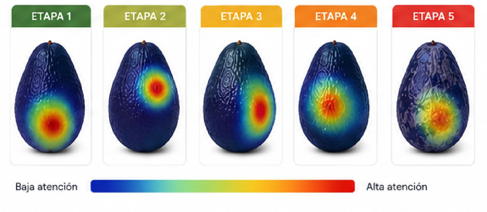 Dashboard completo: clasificación por etapas, matriz de confusión, métricas de desempeño (Accuracy 96.5%, F1 96.3%) y mapas de calor Grad-CAM