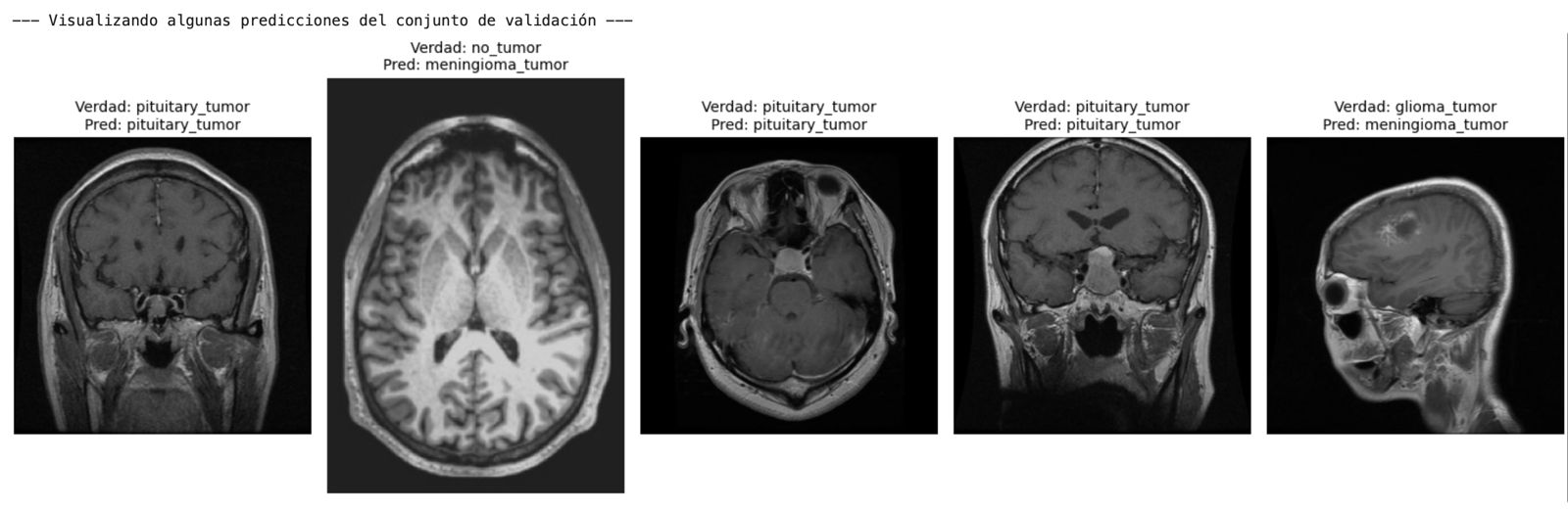Predicciones del modelo sobre resonancias magnéticas cerebrales reales