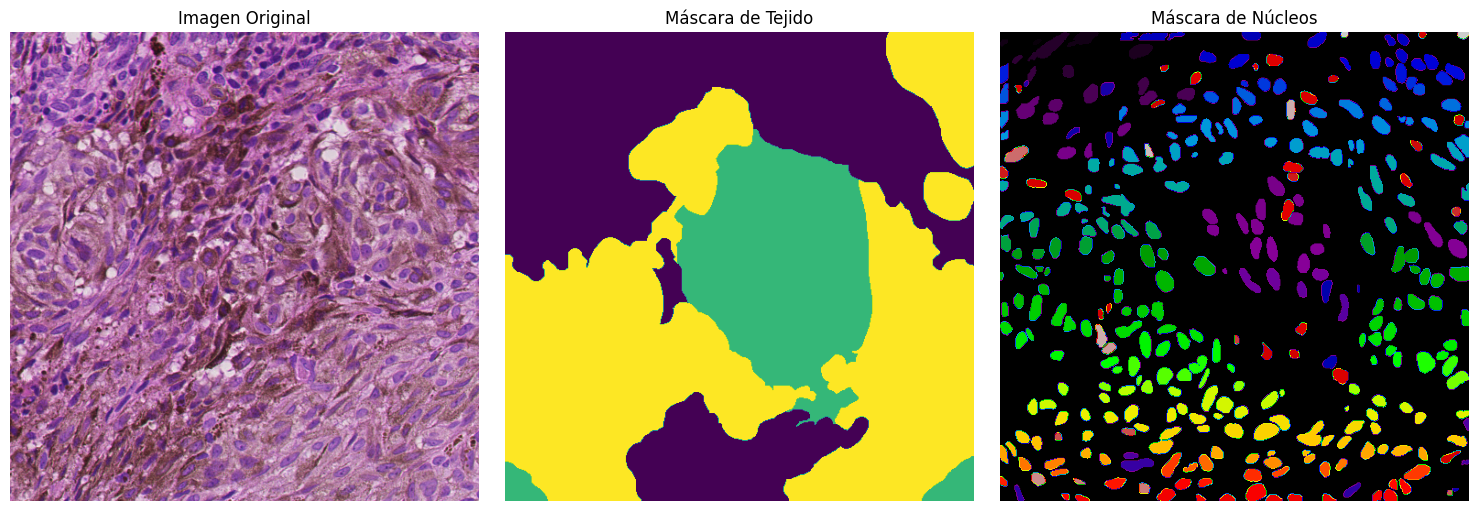 Imagen H&E original, máscara de tejido y máscara de núcleos de una muestra de melanoma metastásico